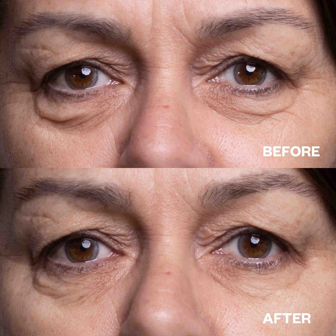 Wrinkle Smoothing Patches