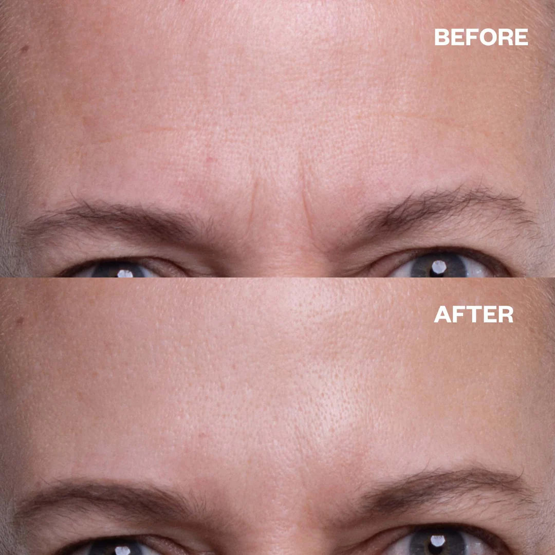 Wrinkle Smoothing Patches