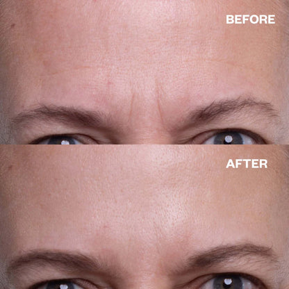 Wrinkle Smoothing Patches